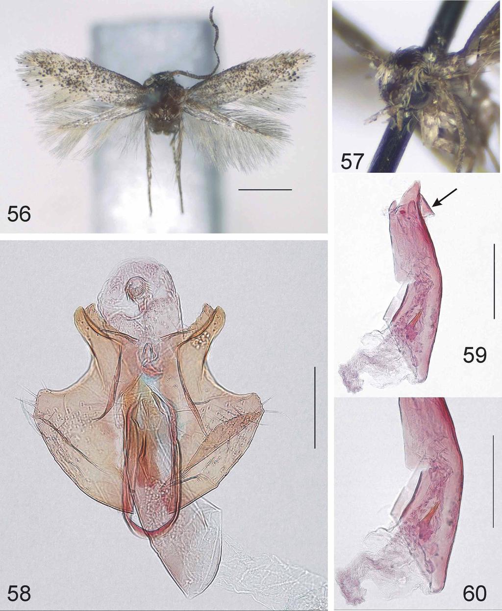 FIGURES 56 60. Urodeta cuspidis, sp. n. 56, adult male. Scale bar 1 mm; 57, head, latero-frontal view. Holotype. Specimen ID: RMCA ENT 000005283; 58, general view of male genitalia. Holotype. Gen.