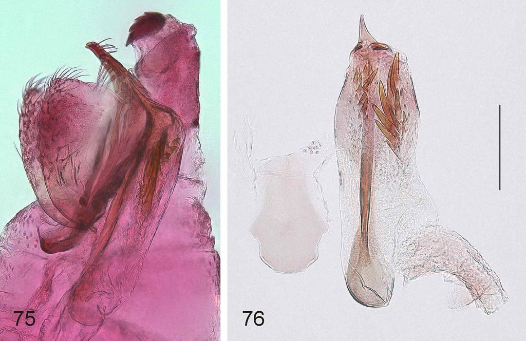 FIGURES 75 76. Urodeta talea, sp. n., male genitalia. 75, lateral view; 76, juxta and phallus. Paratype. Gen. prep.
