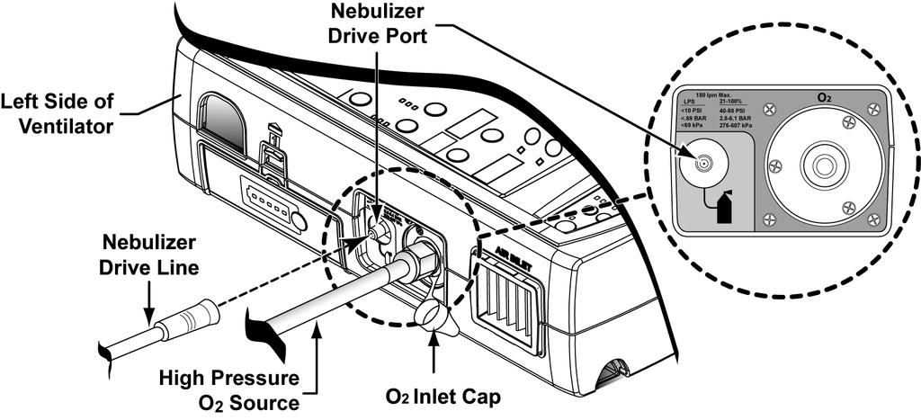 Chapter 2 Installation and Setup Nebulizer The Nebulization procedure can be performed on the Re el ventilator during Volume breaths in Assist/Control mode only.
