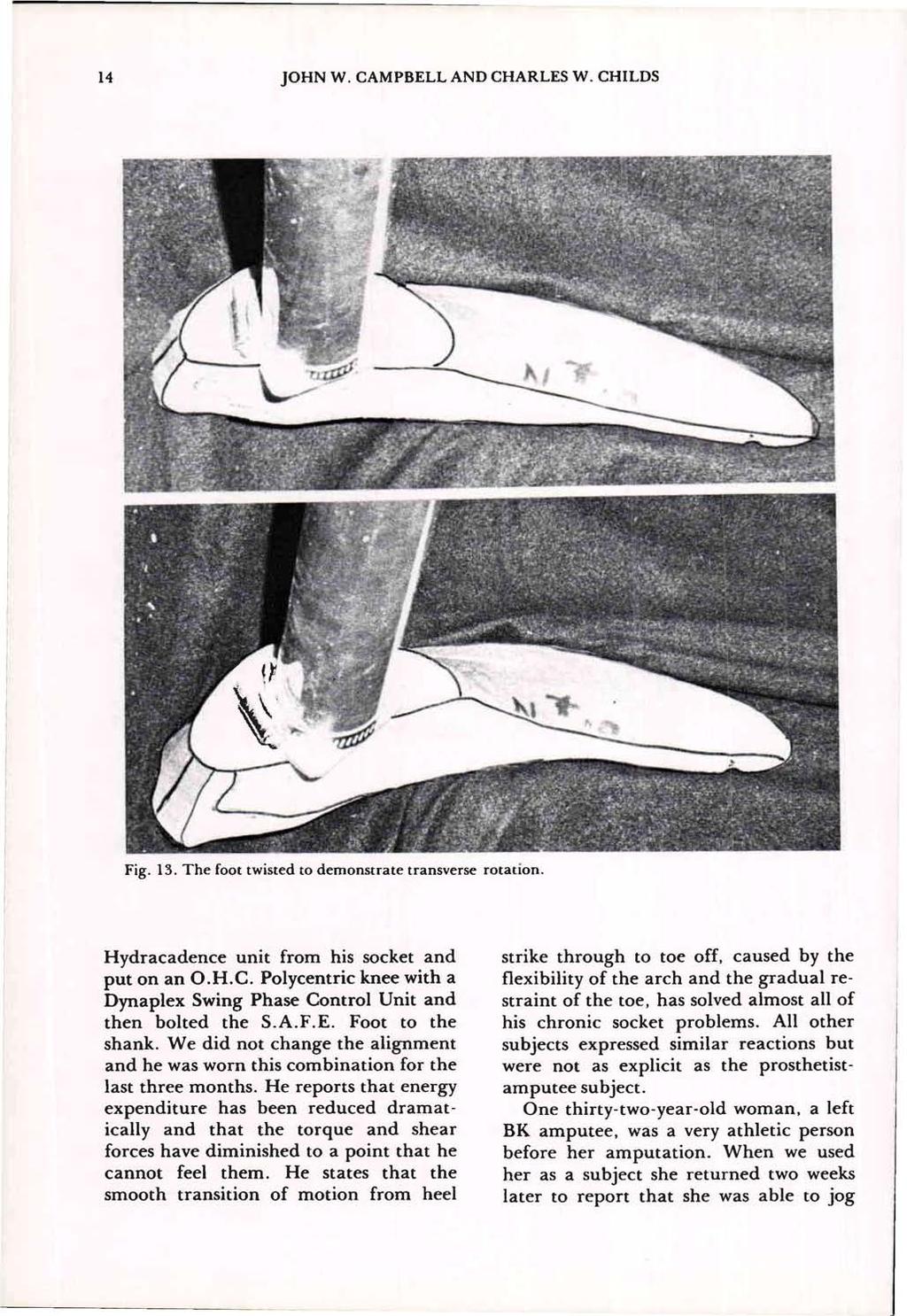 Fig. 13. The foot twisted to demonstrate transverse rotation. Hydracadence unit from his socket and put on an O.H.C. Polycentric knee with a Dynaplex Swing Phase Control Unit and then bolted the S.A.