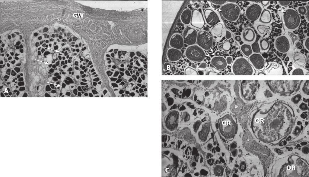 brown bodies (*) 25x. GW, gonadal wall; OR, oocytes in reabsorption. Hematoxylin eosin stain.