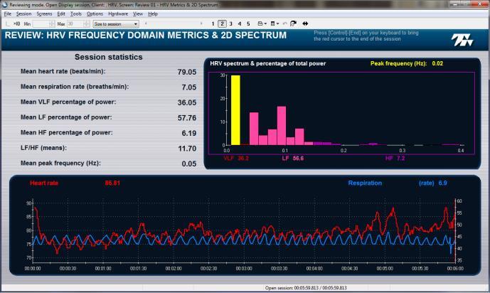 Review 01 - HRV Metrics & 2D Spectrum This screen shows a graph of the respiration and heart rate signals on the bottom, a table of frequency domain metrics on the left and a 2D frequency spectrum