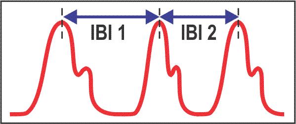 down each time the heart beats. The illustration below shows a graphical representation of the finger pulse signal captured by the blood volume pulse (BVP) sensor.