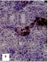 filled by blood cells, but the neck segments showed pale staining (Figure-11).
