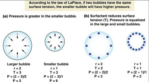 - Surfactant Pressure is greater in the smaller bubble +