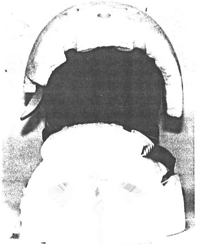 . ' -- Figure 3: Soft shell helmet impacted