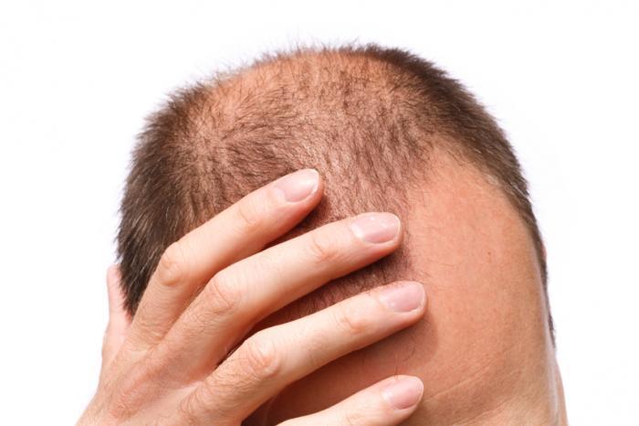 How DHT affects hair growth DHT is necessary for the growth of beard hair but inhibits head hair growth. Hair on the head continually grows without the presence of DHT.