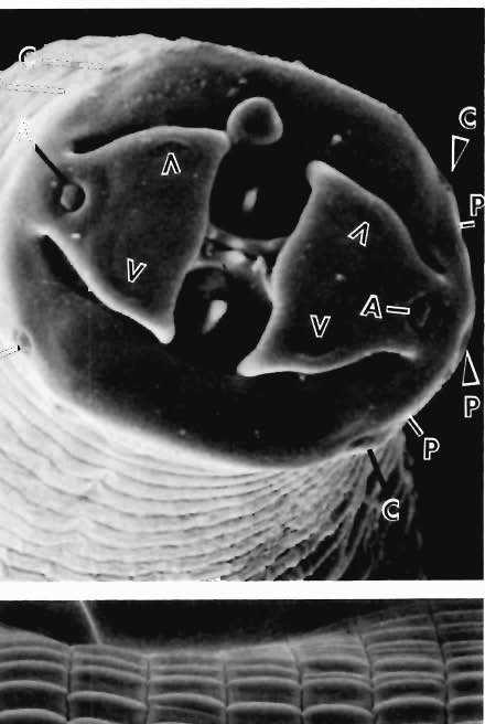 Scanning electron micrograph (SEM) of en face view of head with teeth on interlabial ridges and teeth either side.