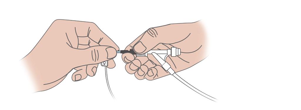 7 Placing right hand palm up, grasp rotating hemostatic valve of injection system with thumb and index finger.