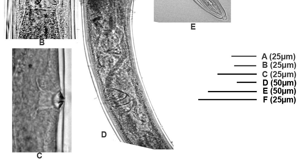 A: head; B: oesophago-intestine junction; C: vulval