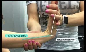 Wrist Flexion: Reference Range 0-60 Measurement: R= _