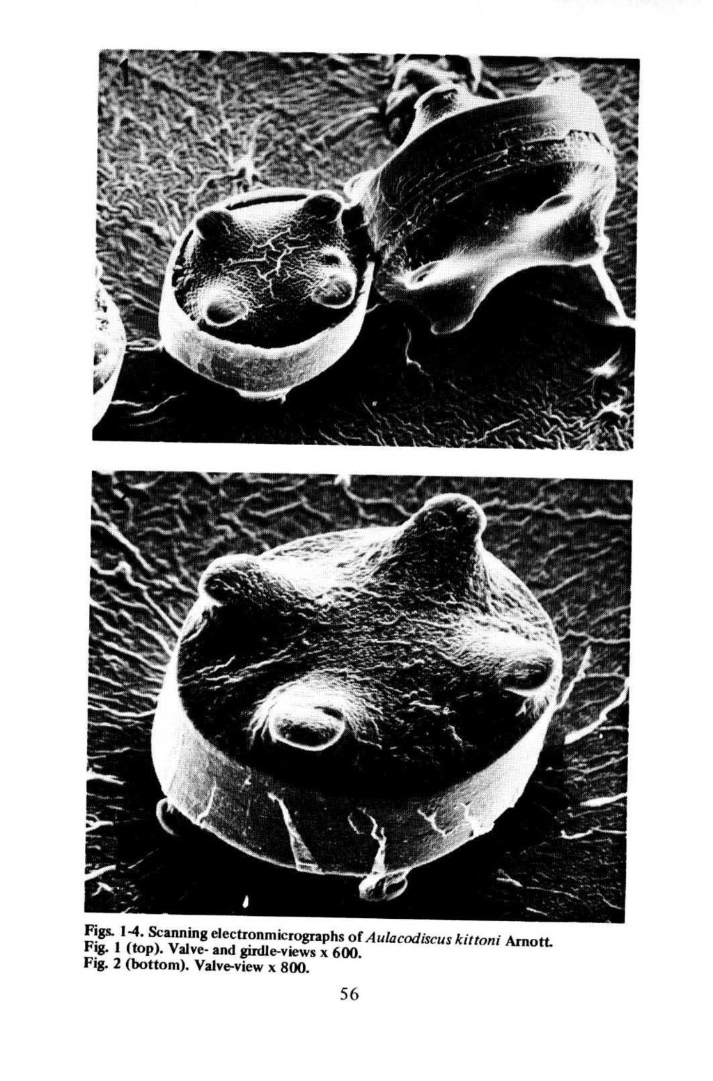 Figs. 1-4. Scanning electronmicrographs of Aulacodiscus kittoni *ig.