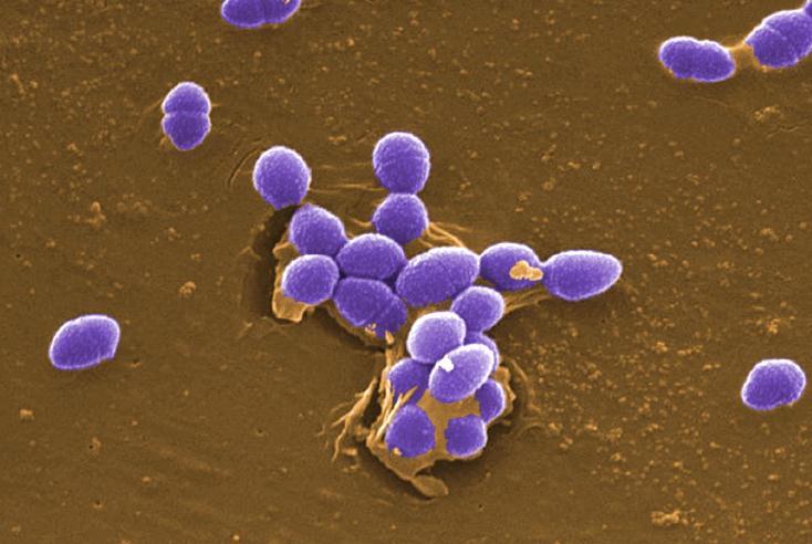 Figure 4 4. Enterococci bacteria b.