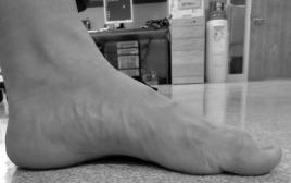 The Foot Core Paradigm A Key to Healthy Feet Irene S.