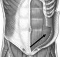 and IR Contralateral Pelvic