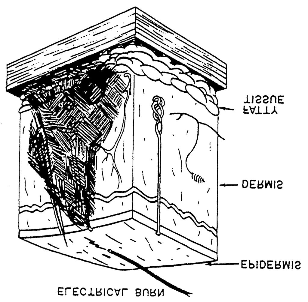Figure 10-46. Electrical penetration of the skin. A drinking fountain maybe used to supply a steady stream of water.