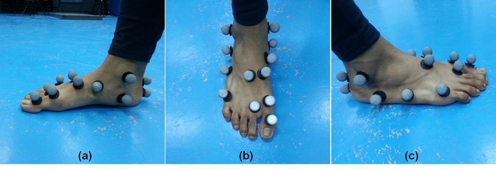 Biomech., vol. 34, no. 10, pp. 12 1307, 2001. [30] R. Ferber and B. Benson, Changes in multisegment foot biomechanics with a heatmouldable semicustom foot orthotic FIGURES device, vol. 4, no. 1, Jun.