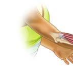 joints. Therefore, excessive postures and activities that engage wrist and finger extension can potentially cause this condition.