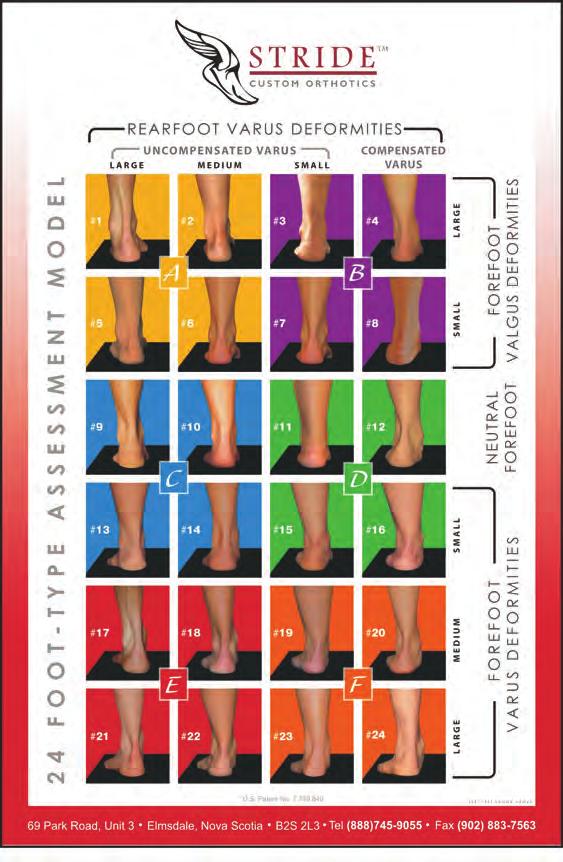 What Makes Stride Custom and Functional Orthotics Unique? What makes Stride unique is our patented foot classification model that identifies 24 congenitally occurring foot types.