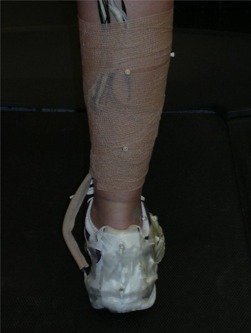 Figure 3.3 Image showing LED marker placement to track motion of the rearfoot. Markers for the thigh and shank were attached directly to the subject s skin using double sided tape (3M Inc.