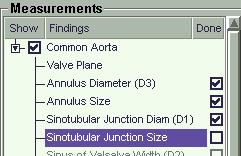 TAVR-Measure/Modify Sinotubular