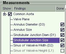 TAVR-Measure/Modify Sinus of Valsalva Height Click on the Sinotubular Junction Size.
