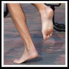 34 BAREFOOT Barefoot athletes landed in a more plantar flexed position at the ankle, resulting in a decrease peak vertical ground reaction force