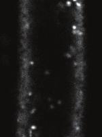 6 µm YFP::NPSN12 BFA Mnnitol Isoxen Control