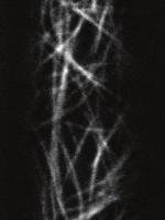 5 0 Isoxen Isx + Tx Figure S5 () SmCCs coloclize with corticl microtuules in cells treted
