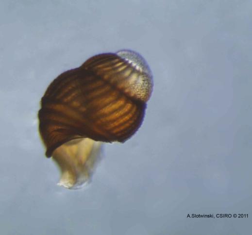 In some species a planktonic larval stage called a trochophore (left figure below) emerges from the egg.