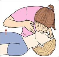 Listen for any breath sounds Feel for any breath on your own cheek/hand Feel for any chest wall/abdominal movement If they are breathing, roll them on to their side into the recovery position, until