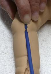 Instructions for Replacing Veins on Nita Newborn TM Continued 3. Continued from page 10... It is important to secure the veins under the tabs in the vein channel.