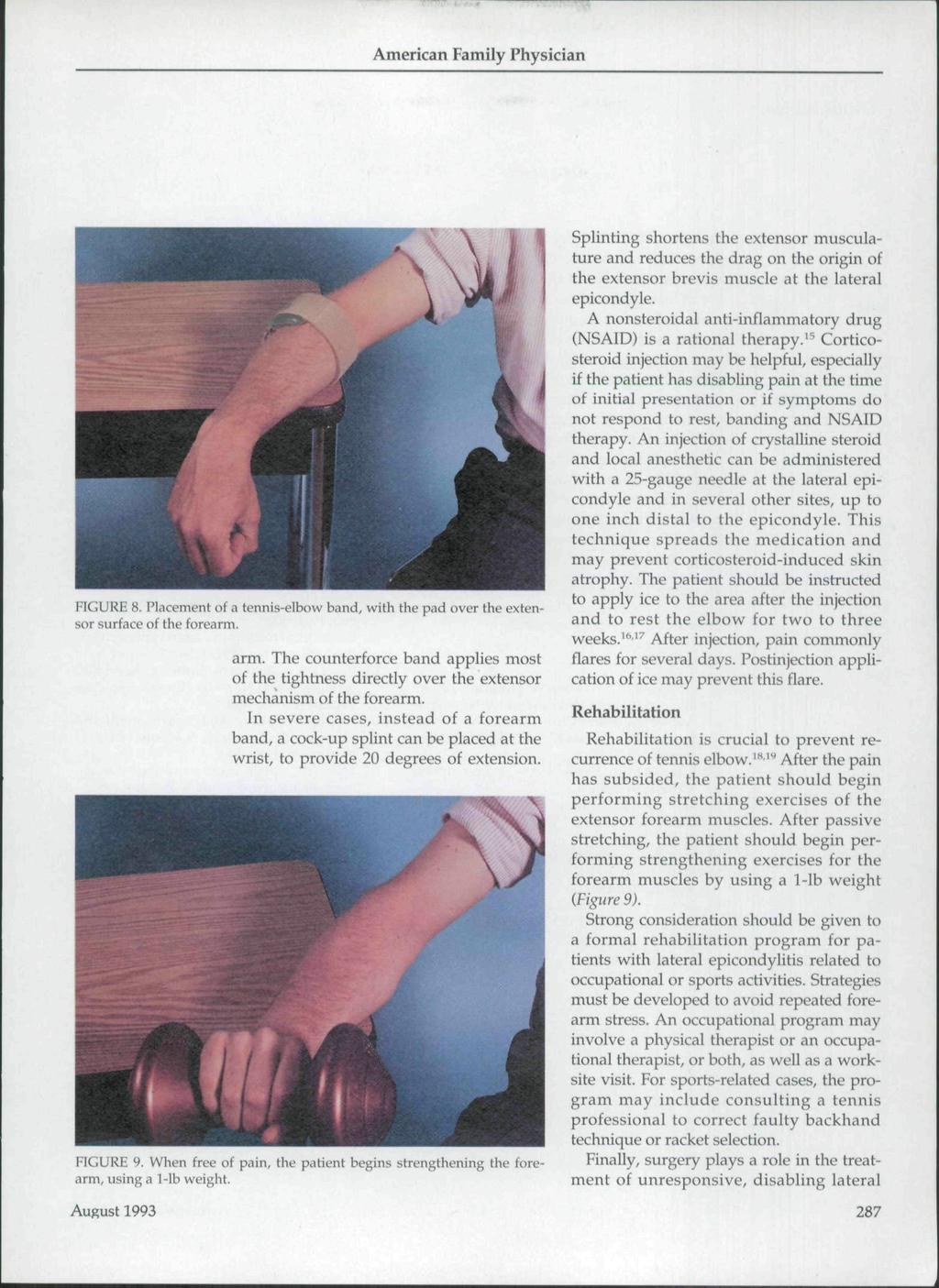 FIGURE 8. ruicement oi a tennis-elbow band, with the pad over the extensor surface of the forearm. arm.
