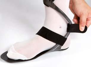 If the patient is wearing shoes with a removable insole, you can use this as a pattern for trimming the orthosis.