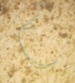 Most common microplastic