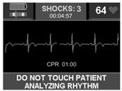 STEP 4: ANALYZE AND SHOCK DELIVERY (AED MODE) The voice and text prompts will guide you through. DO NOT TOUCH PATIENT! ANALYZING RHYTHM.