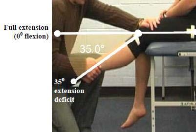 flexion measurement: Degrees