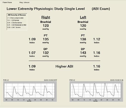 ABI Exam Arm and Ankle Pressures Reference