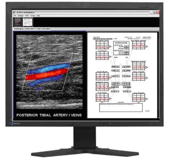 The DICOM Extension Vascular The physician can see both physiological and duplex information for the same patient on the same workstation The DICOM Extension shares data with a PACS system and