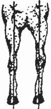 When one side appears to have more mass than the other, a fault exists where the bones of the leg do not fall into a straight line (Figure 3.9)