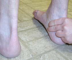 If the ligamentous integrity is intact the arch will raise while supinating the foot.