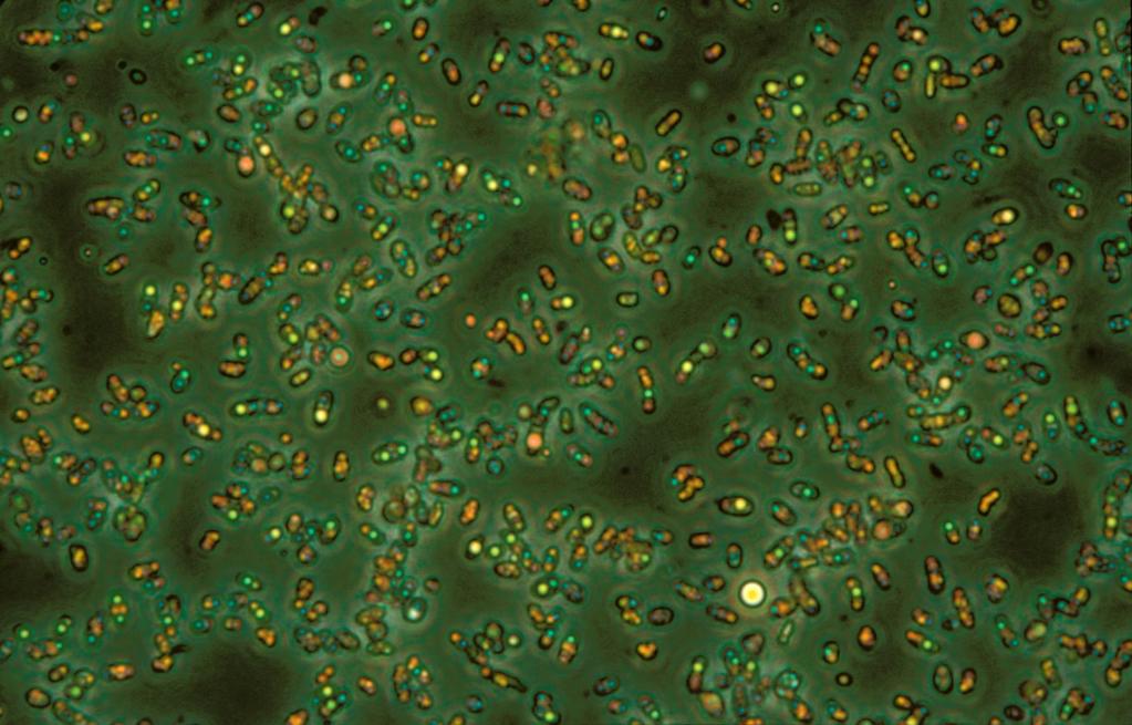 Genus: Paralichthys Species: Size: 1 3 µm (micrometer) Range: