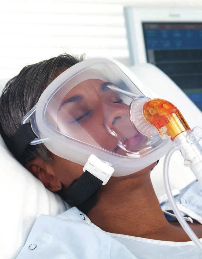 Total face masks Total face masks allow quick fitting and eliminate nasal bridge challenges by sealing around the perimeter of the face, where patients