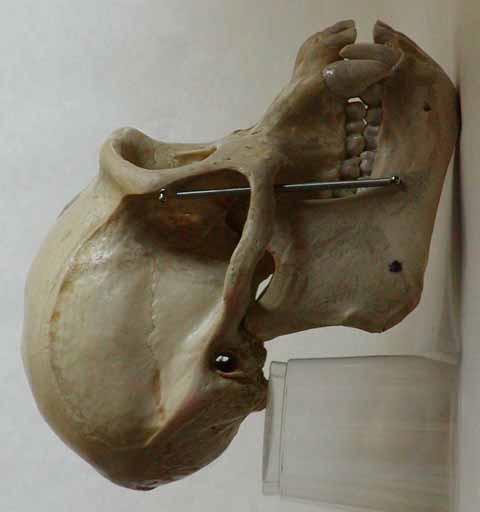 +Pan troglodytes (Modern Chimpanzee) Incisor Angle diastema Chin shape Dental arcade