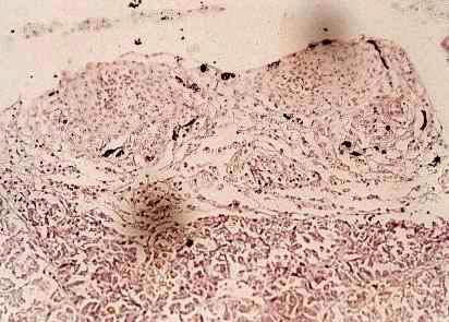 Histological changes in the