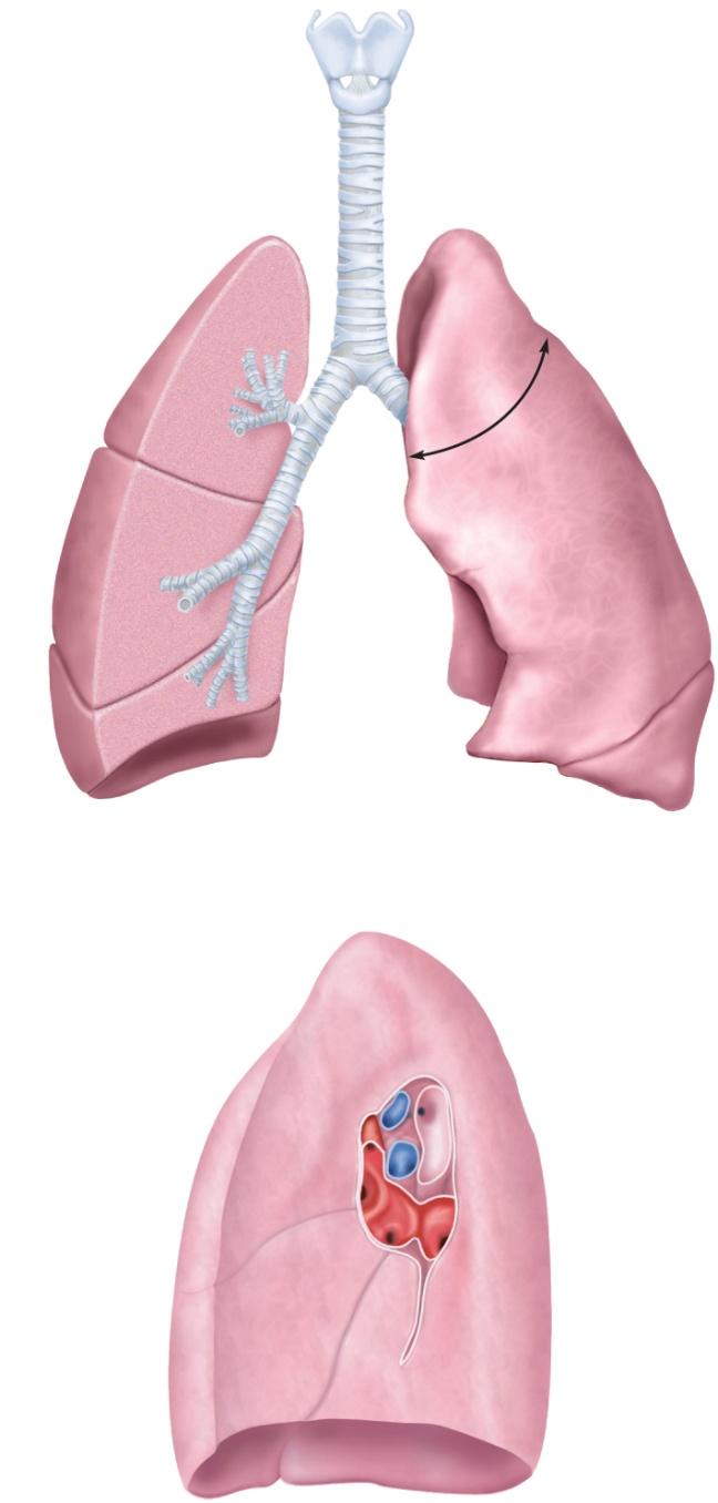 Lungs - Surface Anatomy Copyright The McGraw-Hill Companies, Inc. Permission required for reproduction or display.