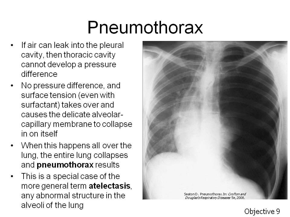 Objective 9. Describe the forces which promote collapse of lung and those which oppose lung collapse. State why pneumothorax leads to atelectasis. Assignment: Tortora, p. 885 or Wiley Plus 23.