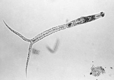Schistosoma 2 nd most common parasitic disease