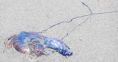 Marine Life Injuries continued Portuguese man-of-war : Special note should be made of this coelenterate.