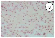 The peripheral cells of the gland are intensely eosinophilic, nucleus has nucleoli.